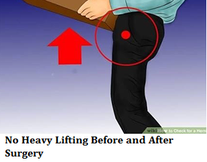 no-heavy-lifting-before-and-after-surgery-1