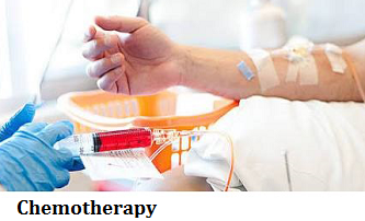 q5-3-chemotherapy
